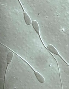 From a photo at http://www.animalimagegallery.org, showing variations in sperm shape and size